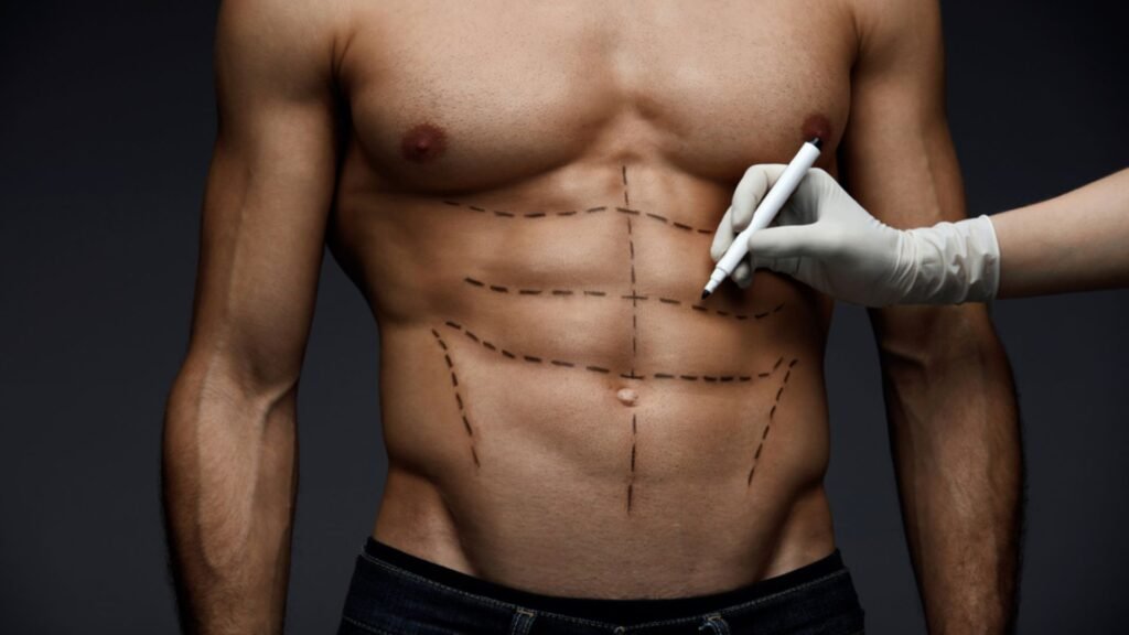 Descubra a Lipo HD